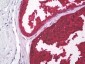KLK3 / PSA Antibody (clone A5D5)